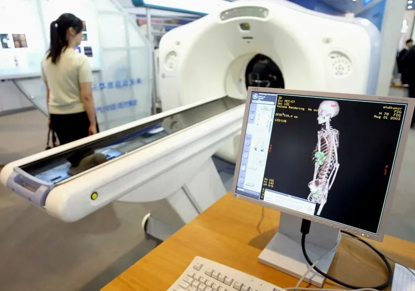 IA Alibaba DAMO RADAR pour l’analyse de scanners abdominaux